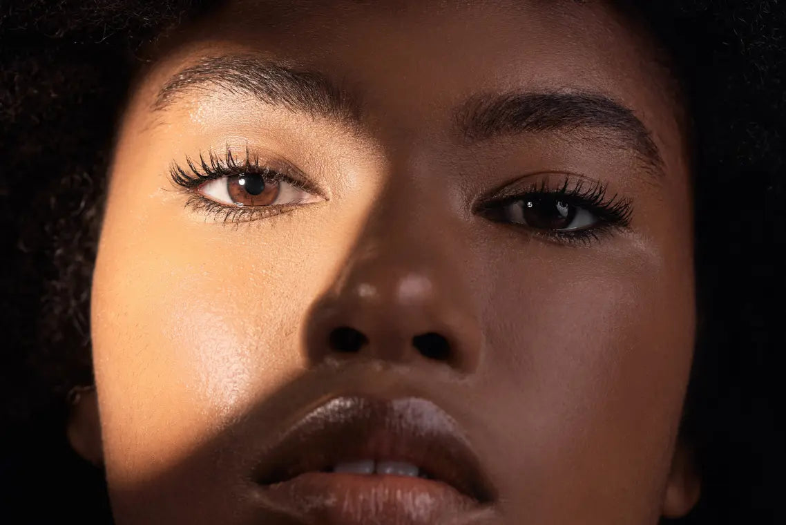 Under Eye Botox Treatment