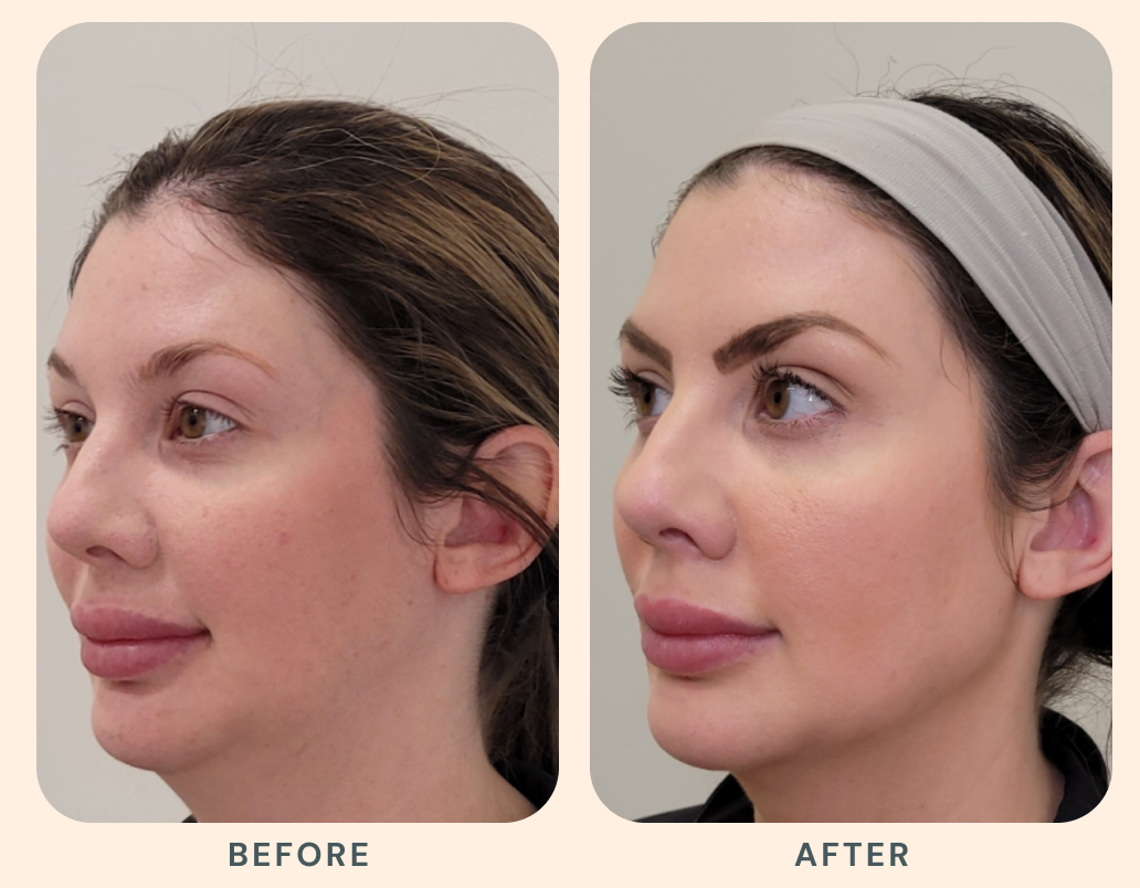 Results that evolve with you.