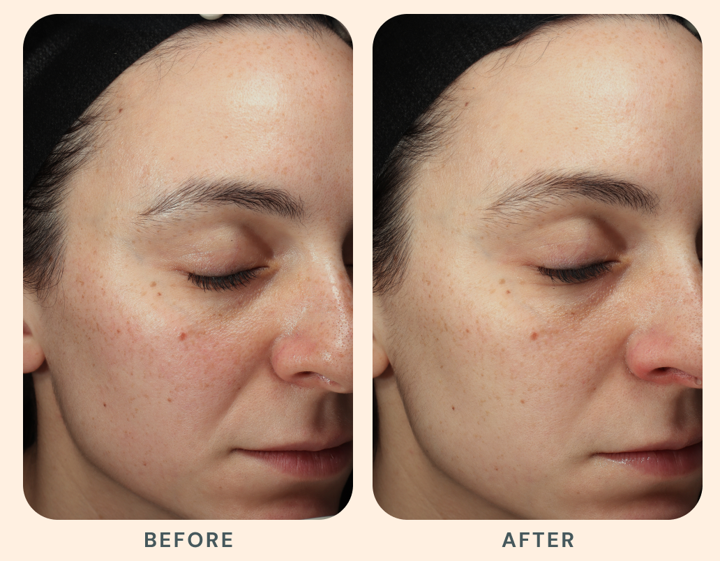 Results that evolve with you.