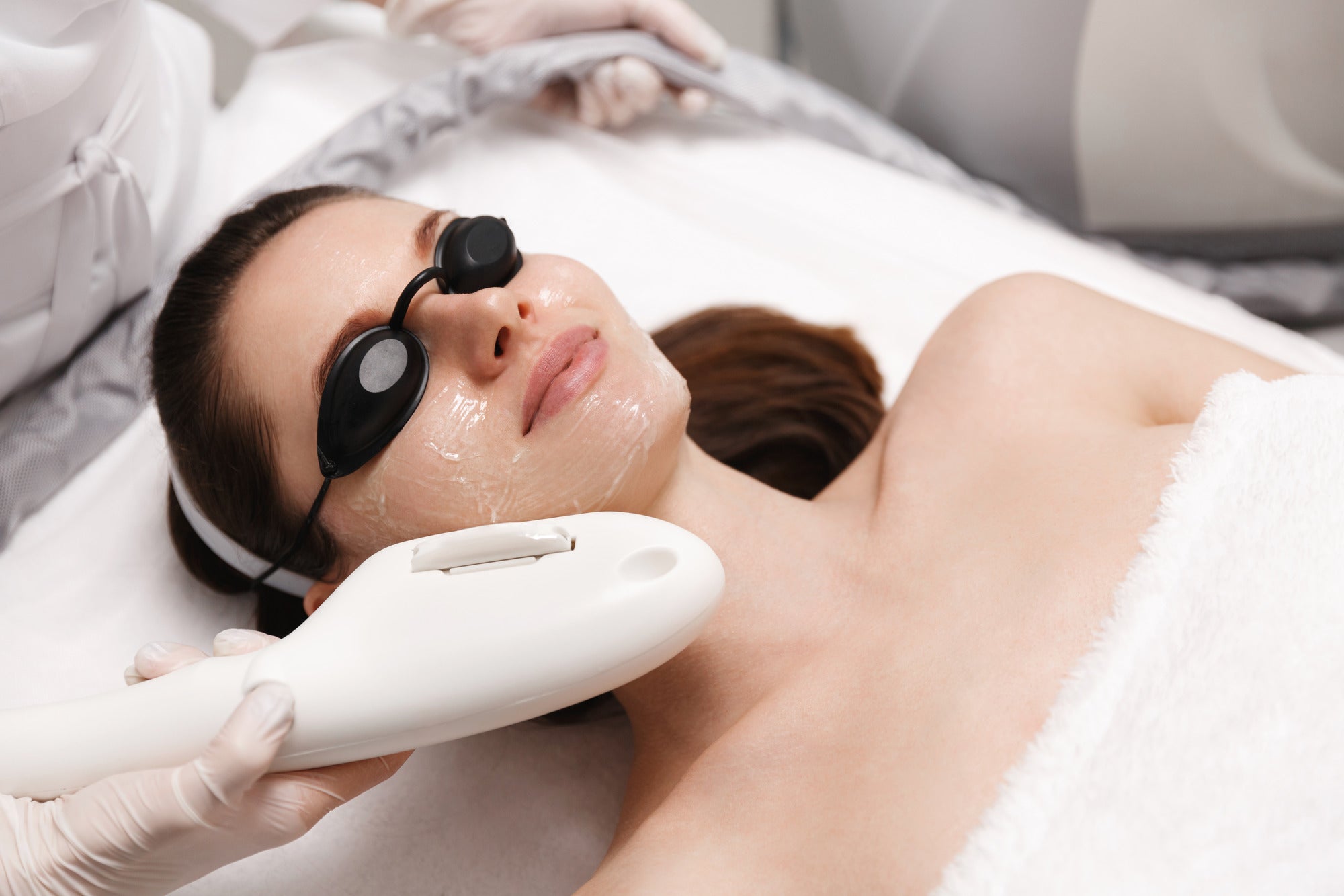 Why Laser Resurfacing is the Ultimate Glow-Up