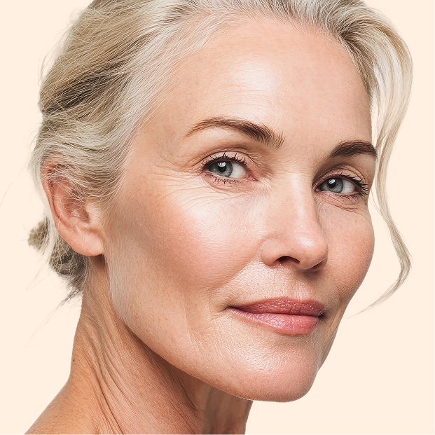 5 Expert-Approved Treatments for Wrinkle Reduction