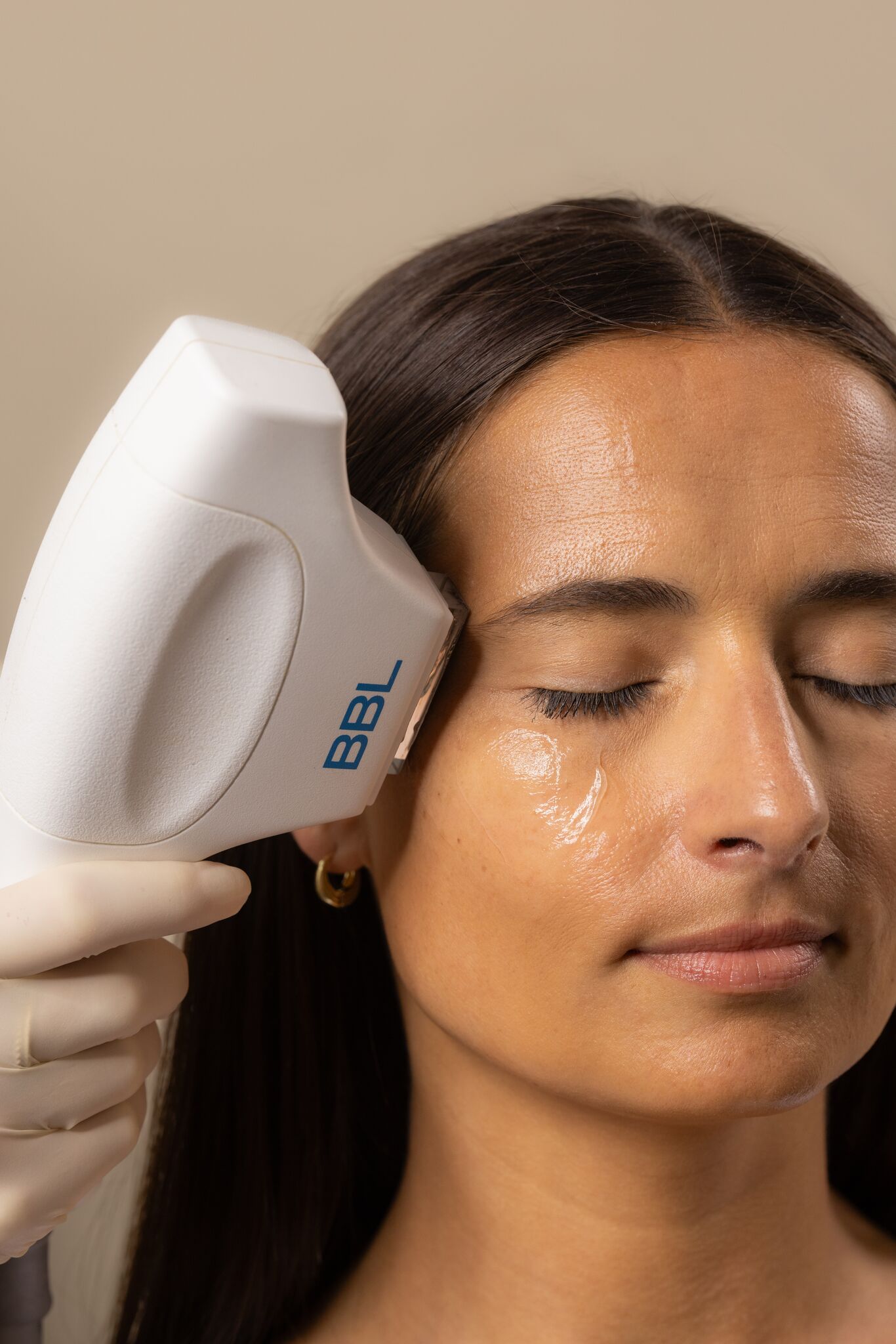 BBL Laser Treatment: What It Treats, What It Costs, and When to Book