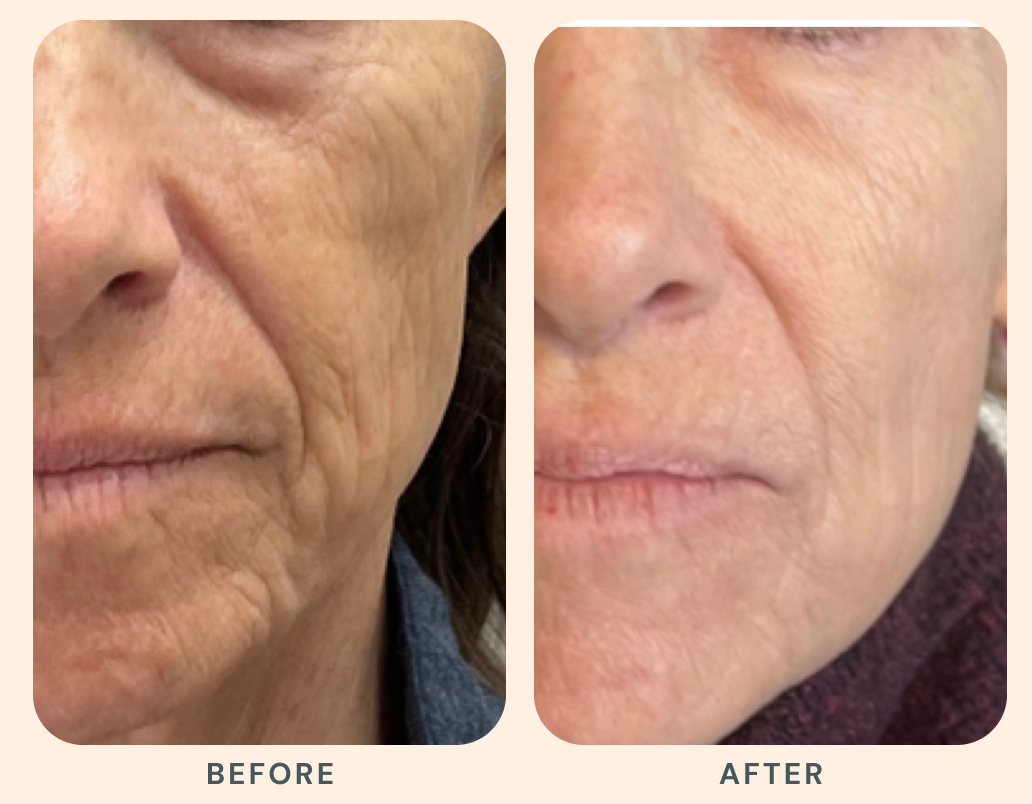 Results that evolve with you.