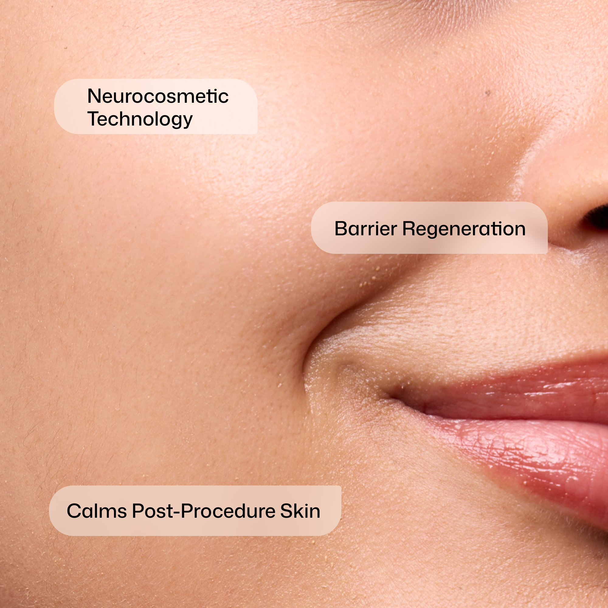 Revision CMT Post Procedure Cream