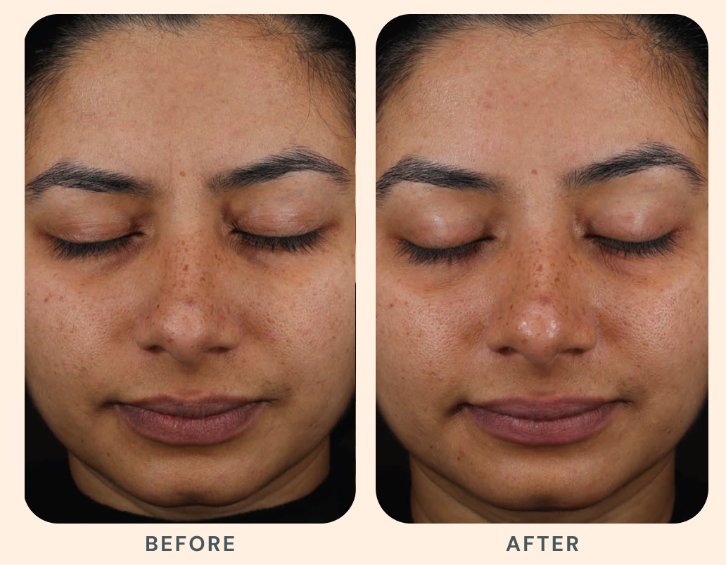 Results that evolve with you.
