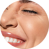 Laser Resurfacing