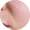 Texture and Smoothness