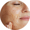 Exfoliator
