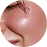 Serum