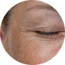Fine Lines and Wrinkles