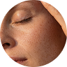 Dry