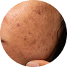 Dark Spots