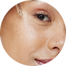 Retinol