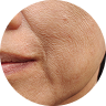 Dull Skin