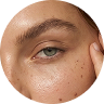 Eye Care