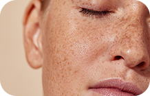 Skin Treatments