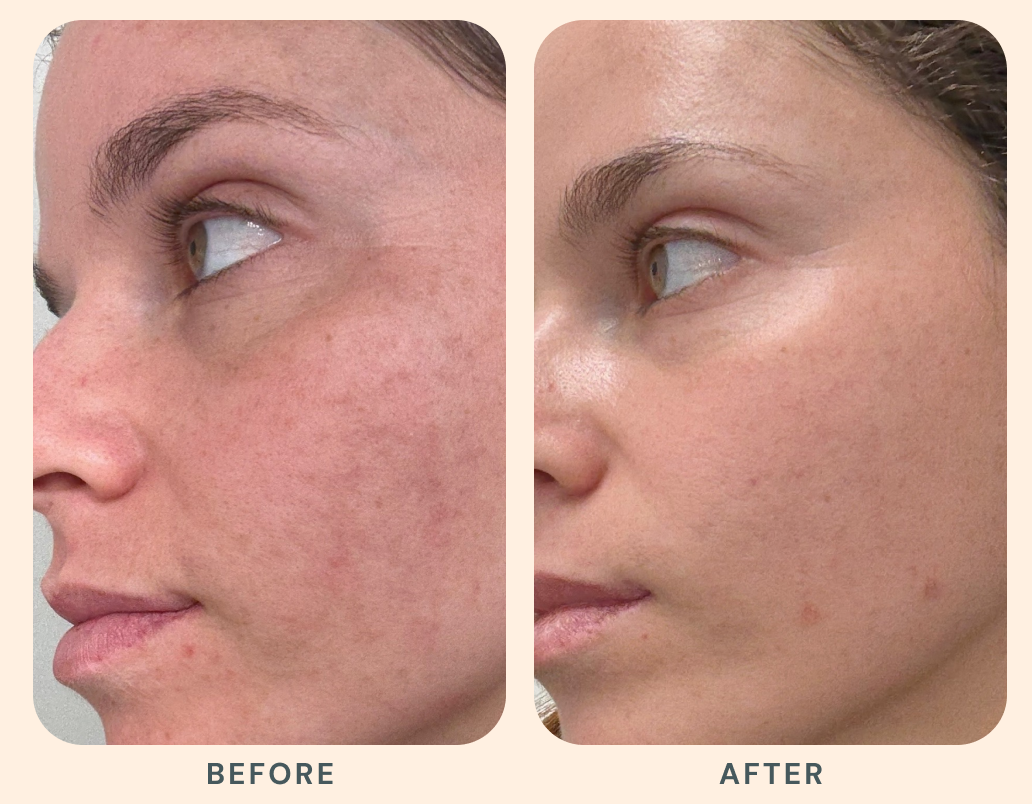Results that evolve with you.