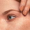 Fine Lines/Wrinkles