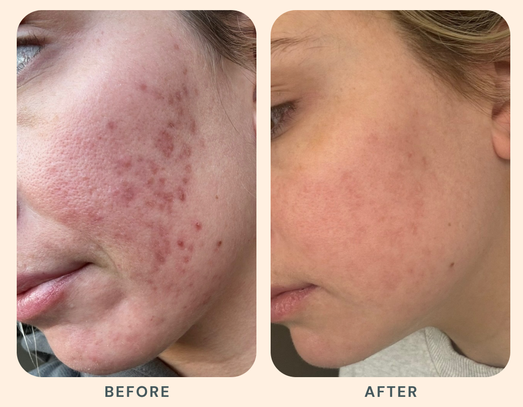 Results that evolve with you.

