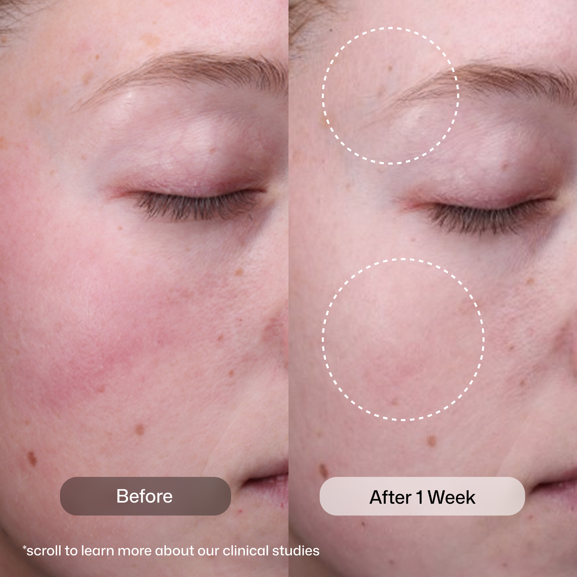 Revision Radiance+ Resurfacing Serum