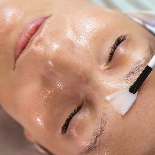 Chemical Peel
