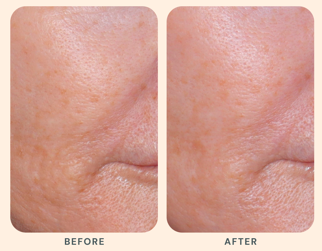 Results that evolve with you.