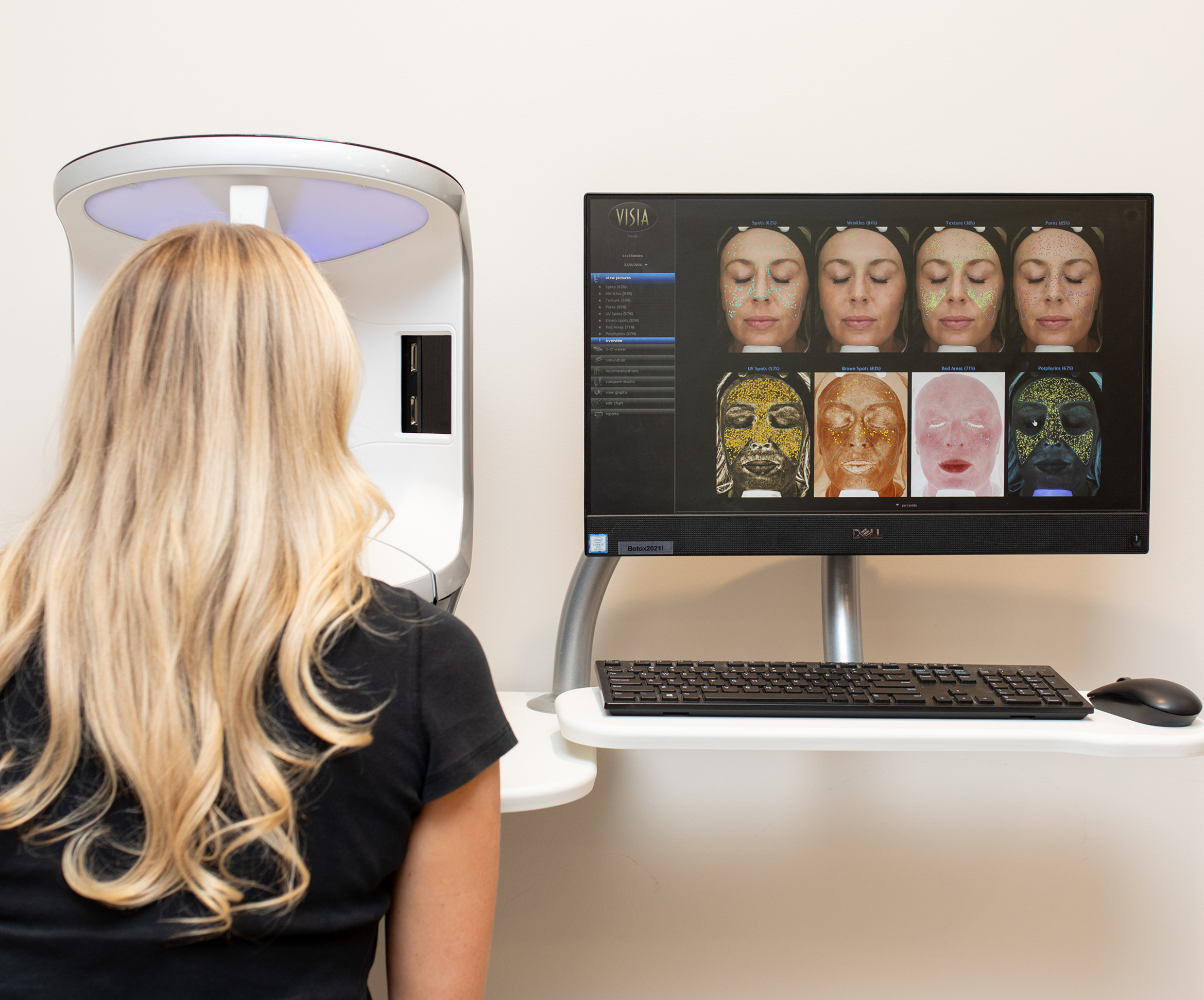 VISIA® Scan & Holistic Approach